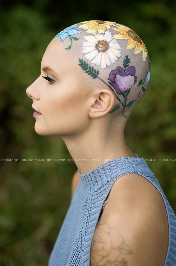 alopecia-senior-photoshoot-madisyn-babcock-chelsea-taylor-3-5a09f3f2774e5-880