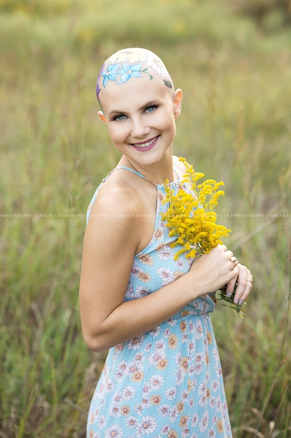 alopecia-senior-photoshoot-madisyn-babcock-chelsea-taylor-5-5a09f3fa00085-880