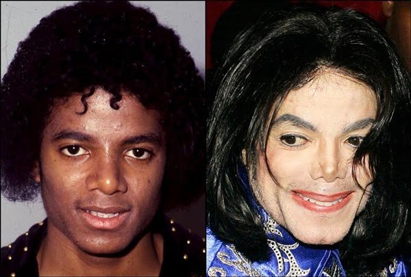 michael-jackson-plastic-surgery-before-after