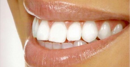 Dijeta za bijele zube