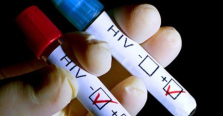 Dvije trećine zaraženih HIV-om ne drže virus pod kontrolom! 