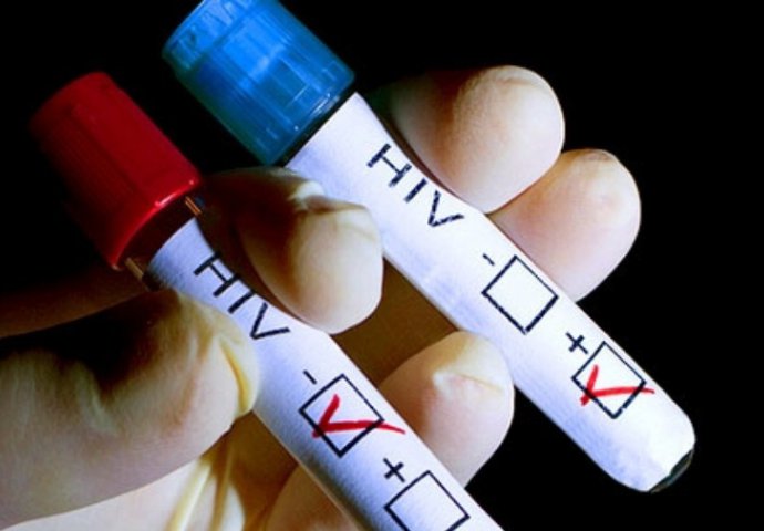 Dvije trećine zaraženih HIV-om ne drže virus pod kontrolom! 