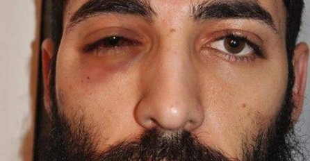 Poznati pariški umjetnik pretučen od četvorice muslimanskih mladića