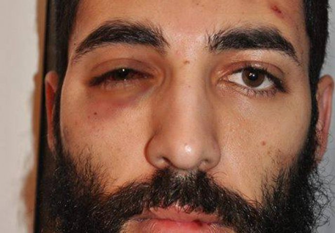 Poznati pariški umjetnik pretučen od četvorice muslimanskih mladića