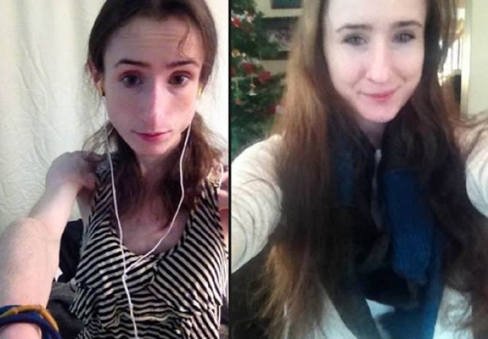 Ovo je pravo lice anoreksije: Njena priča će vas uvjeriti