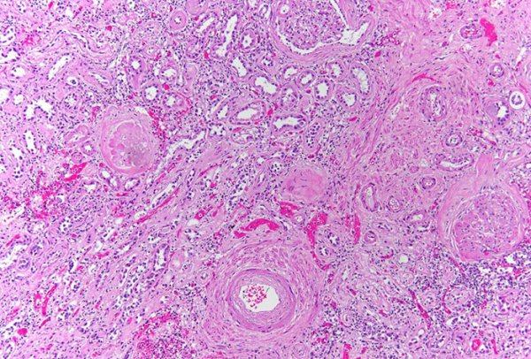 kidney