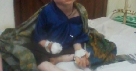 ŠOKANTNO: Dječaku odsjekli šaku zbog vjerovanja da dijelovi tijela albino ljudi donose sreću