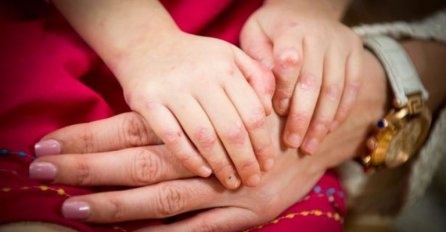 'Djeca leptiri' - 5-godišnja djevojčica ne može zagrliti svoju mamu