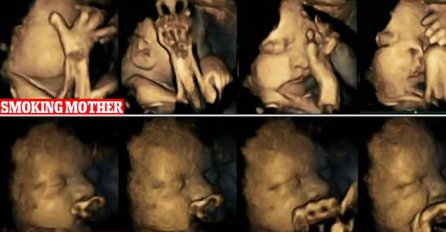 Snimci ultrazvuka pokazuju kako pušenje utiče na nerođene bebe