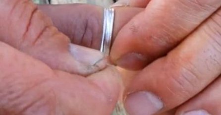 Pogledajte nevjerovatan video - kako skinuti prsten koji sa zaglavio!