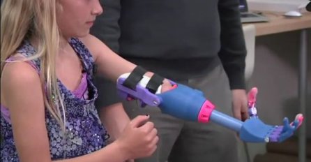 Djevojčica dobila robotičku ruku: "Ovo će promijeniti njen život"