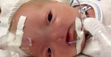 Ovo je priča o malenom Eliju: Rođen s manom koja pogađa tek jednu od 197 miliona beba