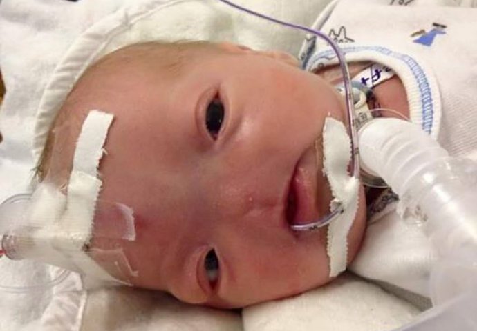 Ovo je priča o malenom Eliju: Rođen s manom koja pogađa tek jednu od 197 miliona beba