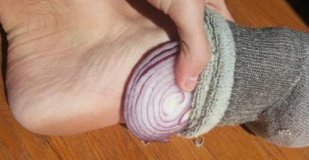 Oaza zdravlja: Crni luk (u čarape i na spavanje)