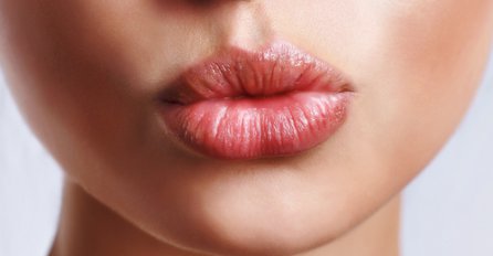 Šta trebate znati o bolesti poljupca