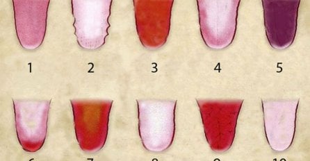 Obratite pažnju: Promjene na jeziku dosta govore o vašem zdravlju!
