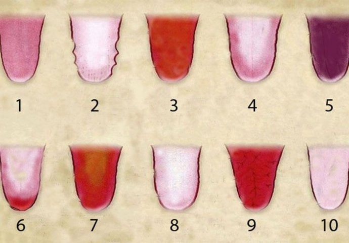 Obratite pažnju: Promjene na jeziku dosta govore o vašem zdravlju!