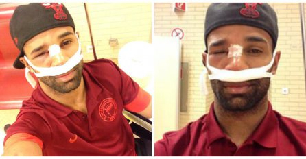 Njemačka zaprepaštena: Igraču polomili kosti, a potezali su se i noževi