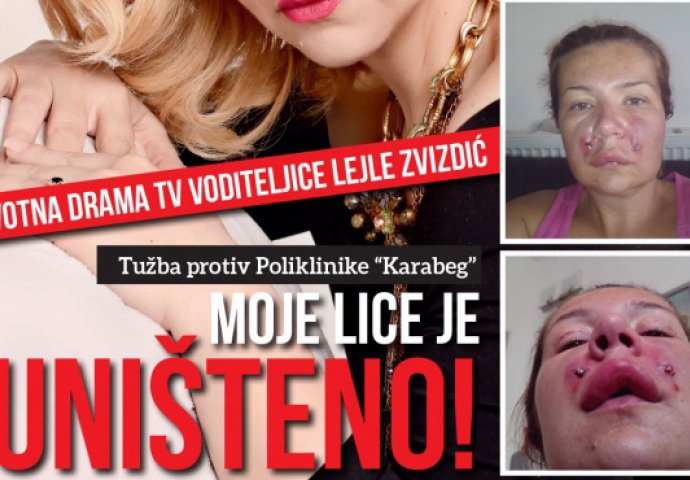 Užasna ispovjest poznate sarajevske TV-voditeljice: Moje je lice uništeno!