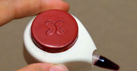 Zaboravite na igle: Osmišljen aparat za bezbolno vađenje krvi