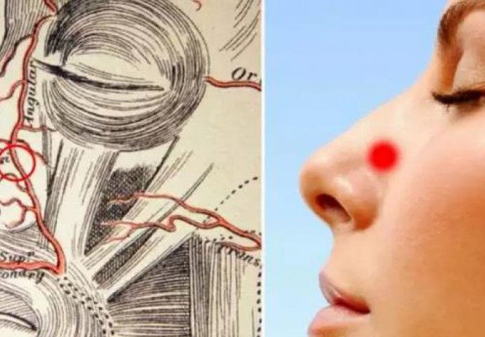 Tri trika koji odmah zaustavljaju krvarenje nosa