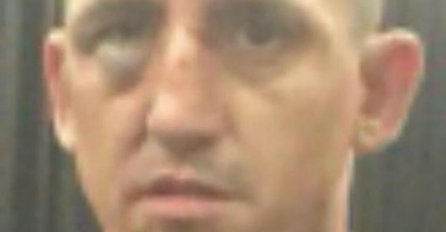 FOTO: Albanac unakazio Kristijana Golubovića: Pogledajte na šta je ličio nakon meča!