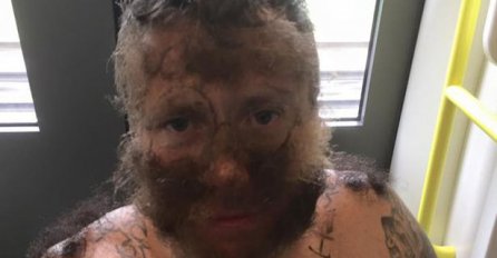 'Momačka' za pamćenje: Lice mu oblijepili svojim dlakama