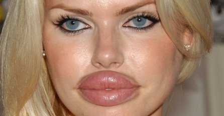 (VIDEO) Kad estetska hirurgija krene po zlu: A htjeli su biti ljepši...