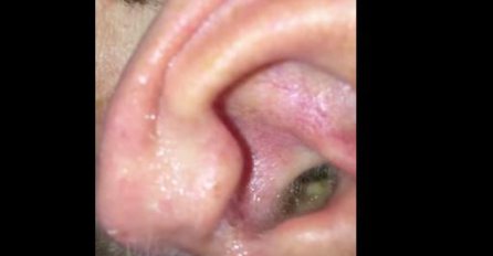 (VIDEO) ŠOK I NEVJERICA: Preko mobitela je pogledao u uho, a onda je ostao bez daha i riječi