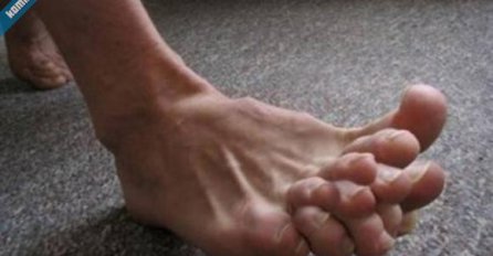 Rodili su se sa viškom organa i dijelova tijela!