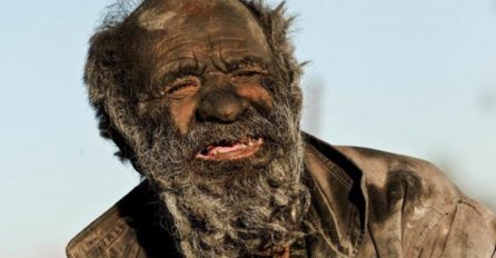 Najprljaviji čovjek na svijetu: Ovako izgleda kada se ne kupate 60 godina