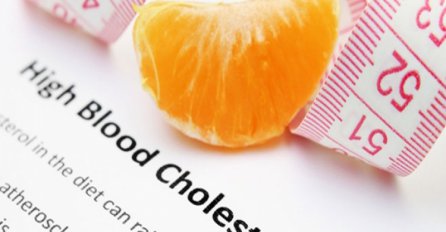 Snizite holesterol na prirodan način