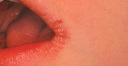 Imate li koji od ovih 5 simptoma? Provjerite, to su znakovi koji nagovještaju nešto loše!