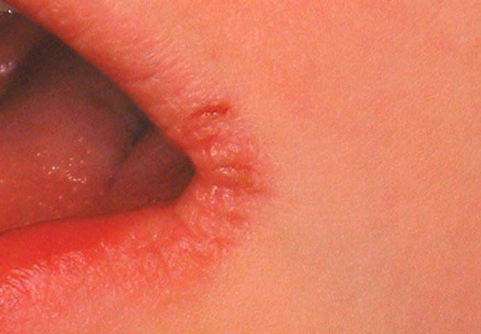 Imate li koji od ovih 5 simptoma? Provjerite, to su znakovi koji nagovještaju nešto loše!