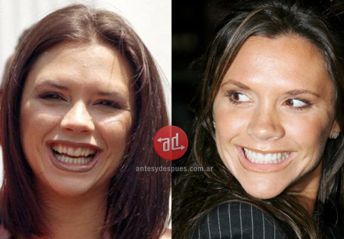 Priroda im nije podarila lijep osmijeh: Iznenadit ćete se kad vidite kako su slavne osobe nekada izgledale!