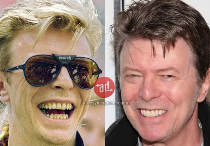 Priroda im nije podarila lijep osmijeh: Iznenadit ćete se kad vidite kako su slavne osobe nekada izgledale!