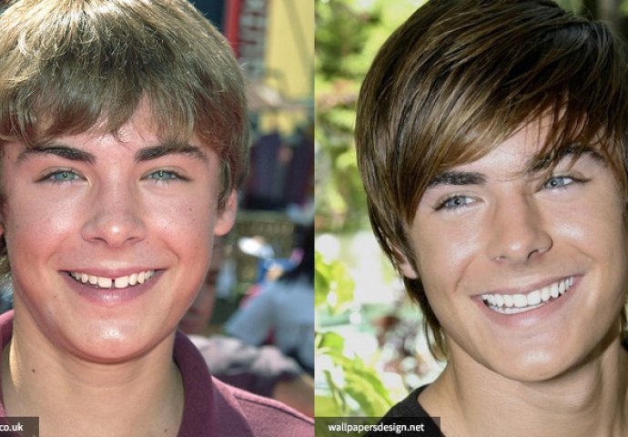 Priroda im nije podarila lijep osmijeh: Iznenadit ćete se kad vidite kako su slavne osobe nekada izgledale!