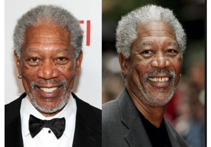 Priroda im nije podarila lijep osmijeh: Iznenadit ćete se kad vidite kako su slavne osobe nekada izgledale!