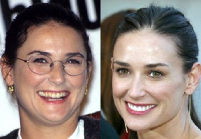 Priroda im nije podarila lijep osmijeh: Iznenadit ćete se kad vidite kako su slavne osobe nekada izgledale!