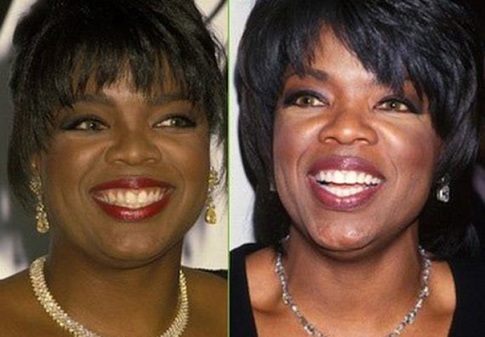 Priroda im nije podarila lijep osmijeh: Iznenadit ćete se kad vidite kako su slavne osobe nekada izgledale!