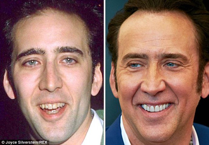 Priroda im nije podarila lijep osmijeh: Iznenadit ćete se kad vidite kako su slavne osobe nekada izgledale!