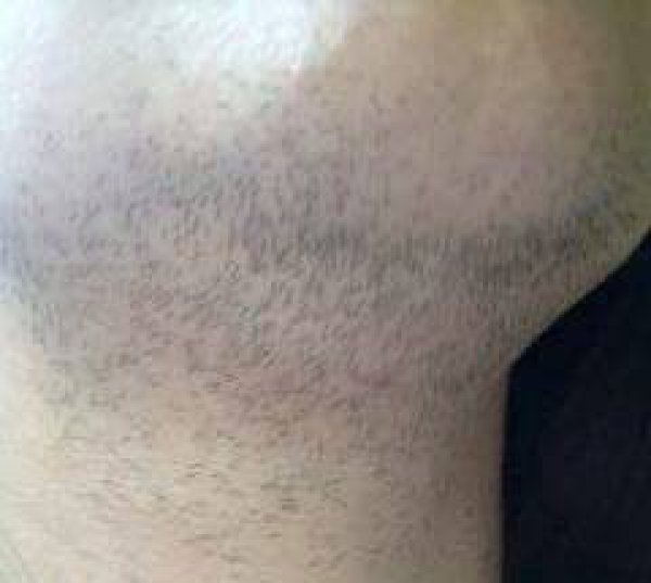 ad-175326091-e1436877006472