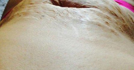 Nakon 13 godina, ponosno je prošetala plažom. Ono što joj se tamo dogodilo, za svaku je osudu!