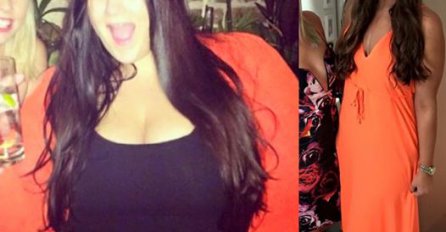 Da se naježiš: Zadivila je svijet i izgubila 85 KG, ali je platila veliku cijenu (FOTO)