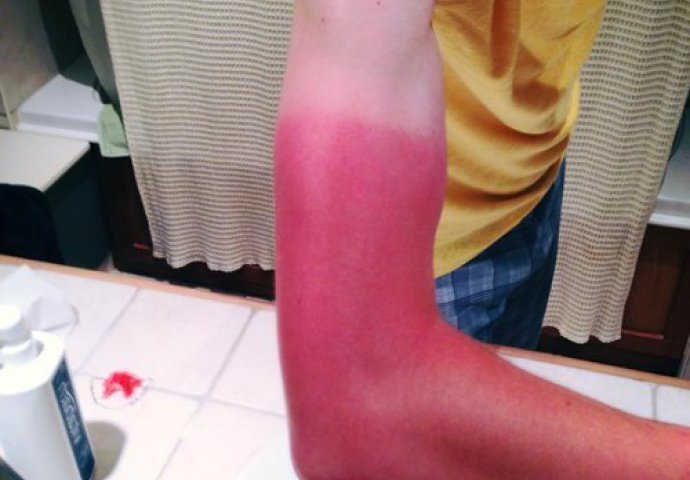 URNEBESNO: Njima bi bilo bolje da nisu uopšte iz kuće izlazili!