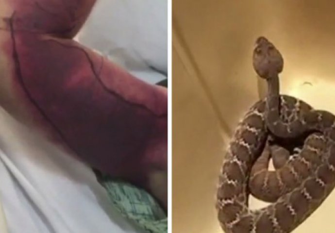 ŠOKANTNO: Nakon ujeda otrovne zmije, u bolnici mu se desio još jedan užas