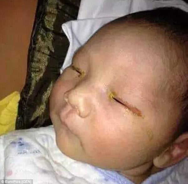 2ae1105200000578-3176237-a-three-month-old-baby-has-been-left-blind-after-a-family-friend-m-21-1438014547432