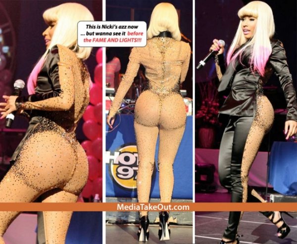nicki-minaj-butt-implants-2