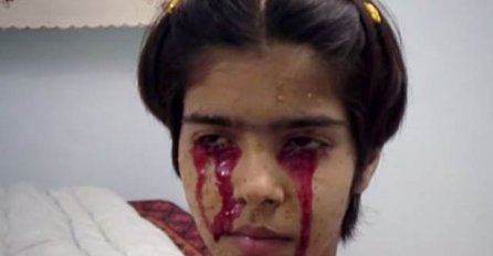 (VIDEO) MEDICINA NEMA ODGOVOR: Djevojčica plače krv! 