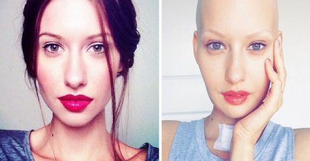 Priča jedne manekenke kojoj je bolest promijenila život!